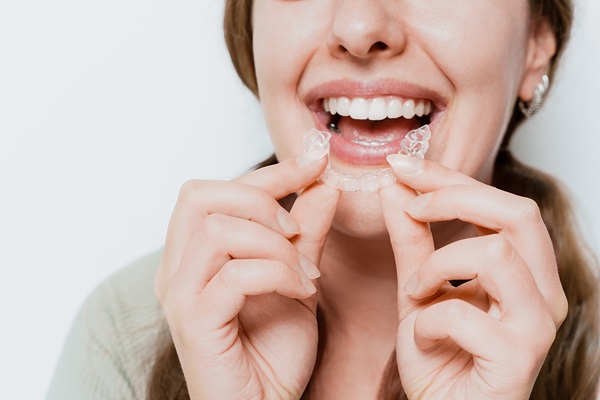 Five Advantages Of Clear Aligners