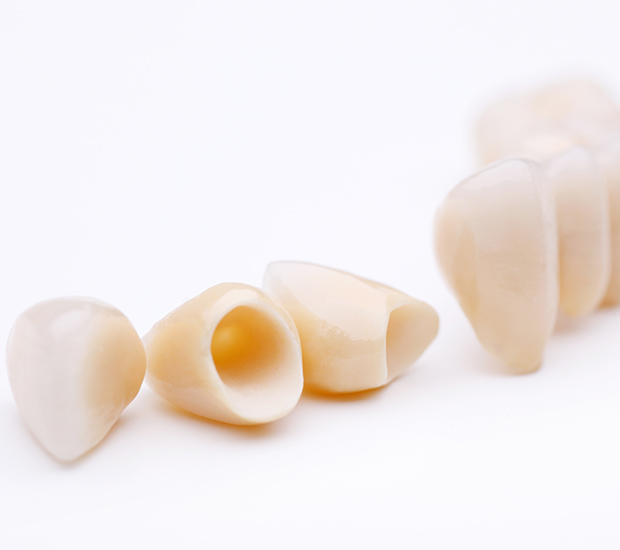 Tamarac Dental Crowns and Dental Bridges