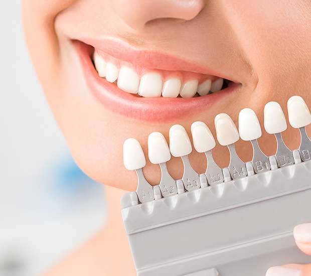 Tamarac Dental Veneers and Dental Laminates