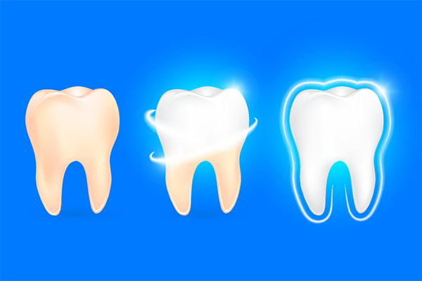 Esthetic Dentistry Considers the Natural and Individual Color Of Teeth from The Dental Place of Tamarac in Tamarac, FL