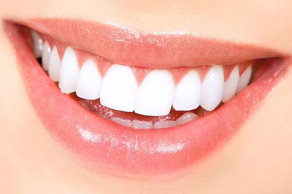 How Long Does Teeth Whitening Take from The Dental Place of Tamarac in Tamarac, FL