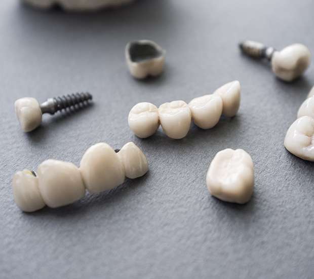 Tamarac The Difference Between Dental Implants and Mini Dental Implants