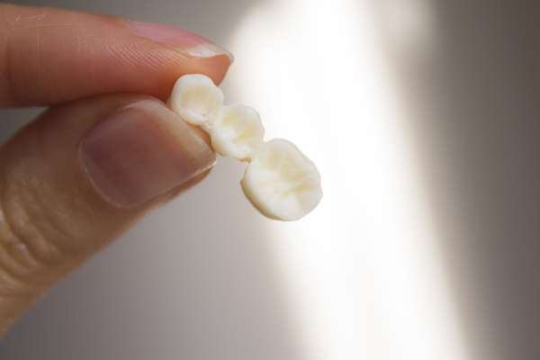 Replace Missing Teeth with Dental Bridges from The Dental Place of Tamarac in Tamarac, FL