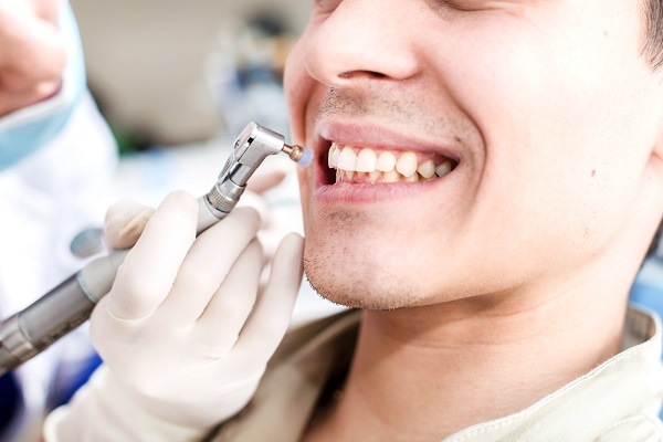 Teeth Cleaning Tamarac, FL