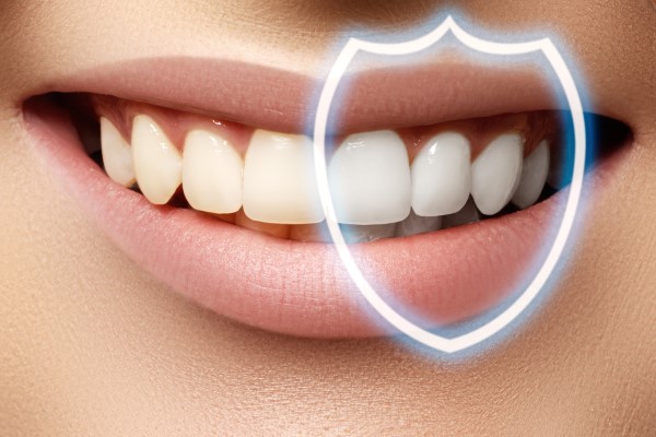 Teeth Whitening Tamarac, FL