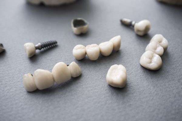 Types of Dental Implants from The Dental Place of Tamarac in Tamarac, FL