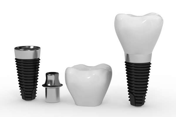 What Are the Parts of Dental Implants from The Dental Place of Tamarac in Tamarac, FL